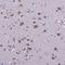 Cancer Susceptibility 4 antibody, HPA043015, Atlas Antibodies, Immunohistochemistry frozen image 