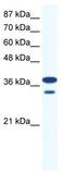 LIM Homeobox 3 antibody, TA330540, Origene, Western Blot image 