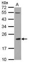 C-Type Lectin Domain Family 4 Member A antibody, PA5-30888, Invitrogen Antibodies, Western Blot image 
