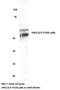 Mitogen-Activated Protein Kinase 8 antibody, AP20730PU-N, Origene, Western Blot image 