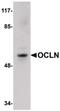 Occludin antibody, PA5-20755, Invitrogen Antibodies, Western Blot image 