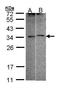 Four And A Half LIM Domains 5 antibody, TA308694, Origene, Western Blot image 
