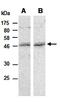NSE2 (MMS21) Homolog, SMC5-SMC6 Complex SUMO Ligase antibody, orb67032, Biorbyt, Western Blot image 