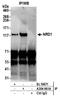 Nardilysin Convertase antibody, A304-961A, Bethyl Labs, Immunoprecipitation image 
