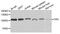 Complement C3d Receptor 2 antibody, A01632-3, Boster Biological Technology, Western Blot image 