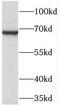 T Cell Immune Regulator 1, ATPase H+ Transporting V0 Subunit A3 antibody, FNab08558, FineTest, Western Blot image 