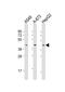 Casein Kinase 2 Alpha 3 antibody, PA5-49512, Invitrogen Antibodies, Western Blot image 