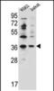 Putative protein phosphatase 1 regulatory inhibitor subunit 3G antibody, PA5-71614, Invitrogen Antibodies, Western Blot image 