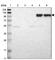 Integrin Subunit Beta 2 antibody, HPA008877, Atlas Antibodies, Western Blot image 