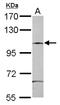 Splicing Factor 3b Subunit 3 antibody, NBP2-20258, Novus Biologicals, Western Blot image 