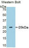 Sclerostin Domain Containing 1 antibody, MBS2005228, MyBioSource, Western Blot image 