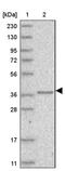 Aminoadipate-Semialdehyde Dehydrogenase-Phosphopantetheinyl Transferase antibody, PA5-55379, Invitrogen Antibodies, Western Blot image 