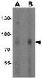 ADAM Metallopeptidase Domain 29 antibody, GTX32157, GeneTex, Western Blot image 