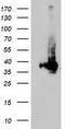 Low Density Lipoprotein Receptor Adaptor Protein 1 antibody, CF503846, Origene, Western Blot image 
