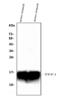 Trefoil Factor 1 antibody, A01391, Boster Biological Technology, Western Blot image 