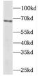 Methionyl Aminopeptidase 2 antibody, FNab05135, FineTest, Western Blot image 