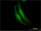 Fanconi anemia group F protein antibody, LS-C197193, Lifespan Biosciences, Immunofluorescence image 