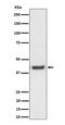 Mevalonate Kinase antibody, M02465-1, Boster Biological Technology, Western Blot image 