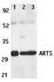 Septin-4 antibody, PA1-30832, Invitrogen Antibodies, Western Blot image 