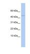 DNA dC->dU-editing enzyme APOBEC-3F antibody, NBP1-57513, Novus Biologicals, Western Blot image 