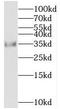 Mediator of RNA polymerase II transcription subunit 4 antibody, FNab05097, FineTest, Western Blot image 