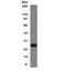 CD79a antibody, V7222-100UG, NSJ Bioreagents, Western Blot image 