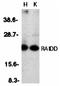 CASP2 And RIPK1 Domain Containing Adaptor With Death Domain antibody, orb74316, Biorbyt, Western Blot image 