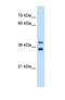 Glycerophosphodiester Phosphodiesterase 1 antibody, NBP1-69654, Novus Biologicals, Western Blot image 