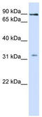 Leucine Rich Repeat Containing 8 VRAC Subunit B antibody, TA341970, Origene, Western Blot image 