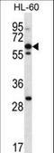 Neuronal pentraxin receptor antibody, LS-C162974, Lifespan Biosciences, Western Blot image 
