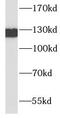 CDHE antibody, FNab10112, FineTest, Western Blot image 