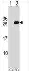 Ubiquitin Conjugating Enzyme E2 T antibody, LS-C157312, Lifespan Biosciences, Western Blot image 