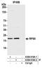 Ribosomal Protein S5 antibody, A304-010A, Bethyl Labs, Immunoprecipitation image 