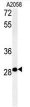 ADP Ribosylation Factor Like GTPase 14 Effector Protein antibody, AP50428PU-N, Origene, Western Blot image 