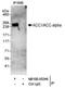 Acetyl-CoA Carboxylase Alpha antibody, NB100-55246, Novus Biologicals, Immunoprecipitation image 
