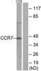 C-C Motif Chemokine Receptor 7 antibody, TA313637, Origene, Western Blot image 