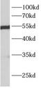 Aldehyde Dehydrogenase 7 Family Member A1 antibody, FNab00299, FineTest, Western Blot image 