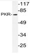 Interferon-induced, double-stranded RNA-activated protein kinase antibody, AP20748PU-N, Origene, Western Blot image 