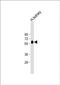 Putative gamma-glutamyltranspeptidase 3 antibody, PA5-72348, Invitrogen Antibodies, Western Blot image 