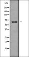 Rho Guanine Nucleotide Exchange Factor 19 antibody, orb378230, Biorbyt, Western Blot image 