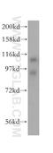 LIM domain and actin-binding protein 1 antibody, 16639-1-AP, Proteintech Group, Western Blot image 