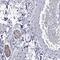 Myelin Protein Zero antibody, HPA068925, Atlas Antibodies, Immunohistochemistry frozen image 