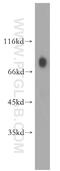 Ubiquitin Specific Peptidase 44 antibody, 15521-1-AP, Proteintech Group, Western Blot image 