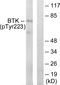 ATK antibody, AP55690PU-S, Origene, Western Blot image 