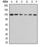 Aldehyde Dehydrogenase 1 Family Member L1 antibody, orb341235, Biorbyt, Western Blot image 