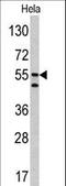 Carbonic Anhydrase 9 antibody, LS-C100340, Lifespan Biosciences, Western Blot image 