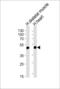 Hemojuvelin BMP Co-Receptor antibody, 64-070, ProSci, Western Blot image 