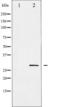 Snail Family Transcriptional Repressor 1 antibody, TA325861, Origene, Western Blot image 