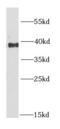 Ring Finger Protein 2 antibody, FNab07348, FineTest, Western Blot image 