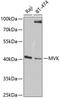 Mevalonate Kinase antibody, GTX54347, GeneTex, Western Blot image 